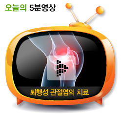 퇴행성 관절염의 치료