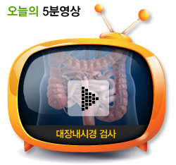 대장내시경 검사